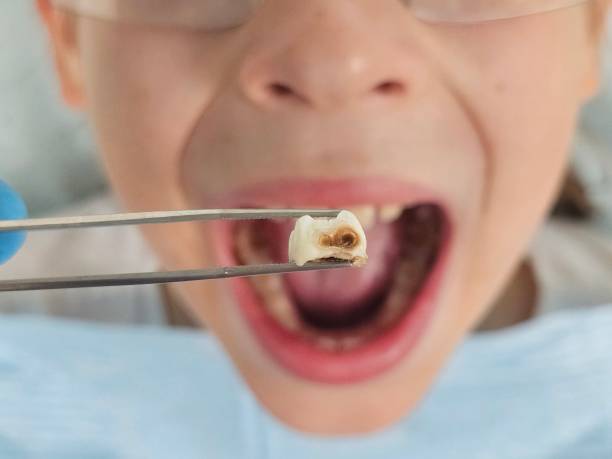 Best Emergency Dental Care for Broken or Chipped Teeth in Minerva Park, OH